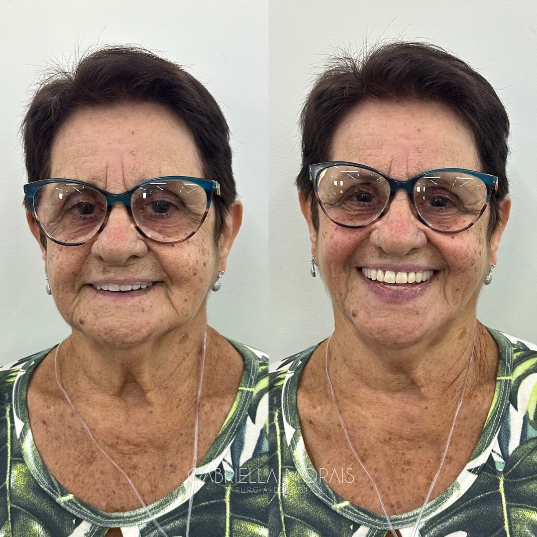 Caso 7 - Antes e Depois